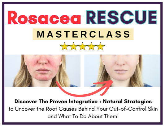 "Rosacea Rescue Masterclass" with before and after photos showing facial redness.